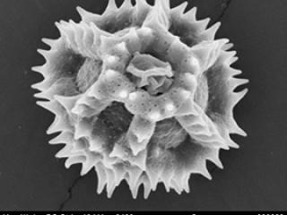 A microscopic view of spiny pollen from a native wild dandelion species in the southern Rocky Mountains.