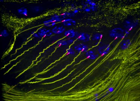 centrosome