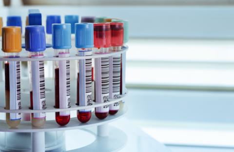 Blood samples in test tubes