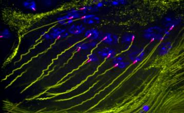 centrosome